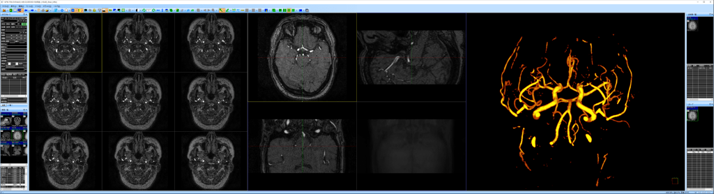 DICOM画像の表示