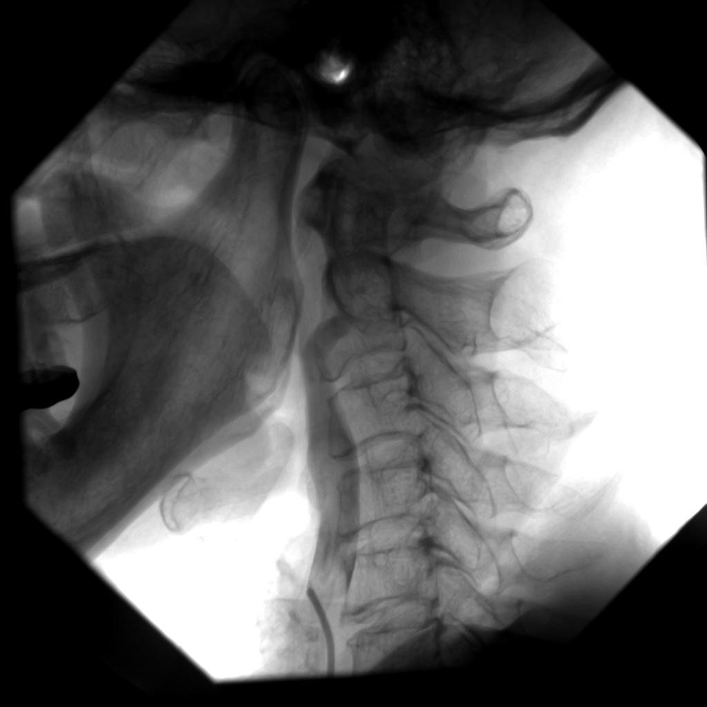 Modality LUT適用後