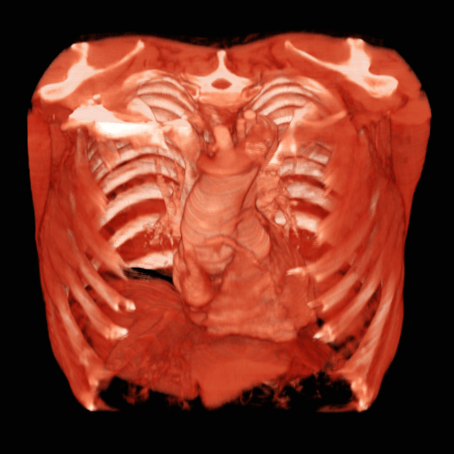 オーバーレイなし