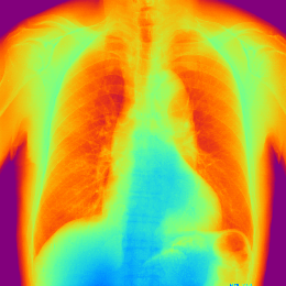 擬似カラー表示