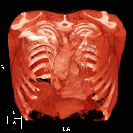 オーバーレイ表示