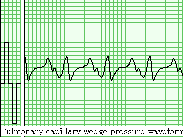 Waveform表示(局部拡大)